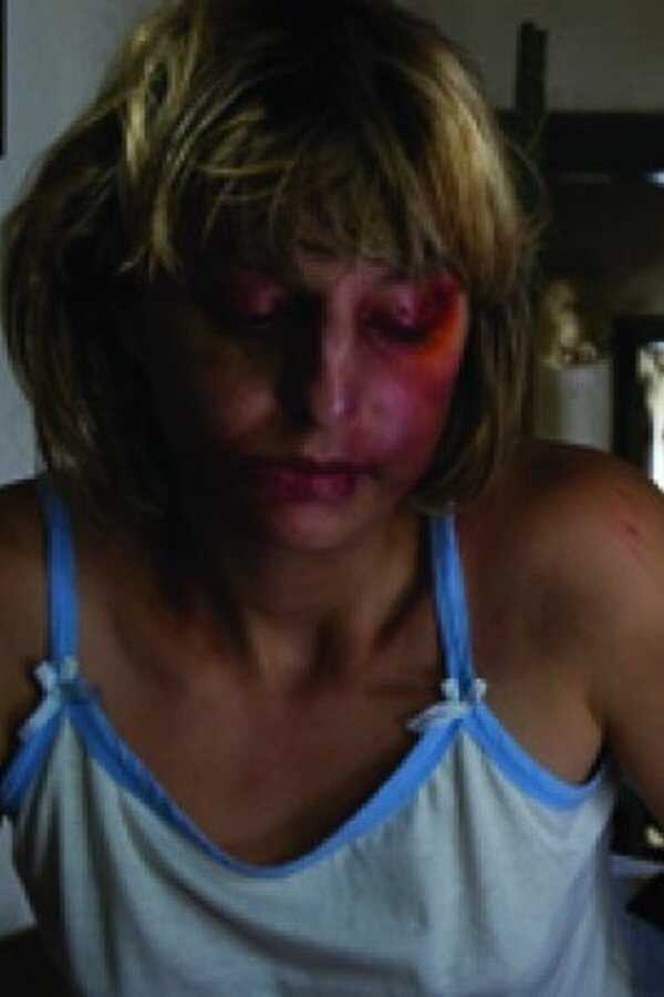 Metastases (2009) 0